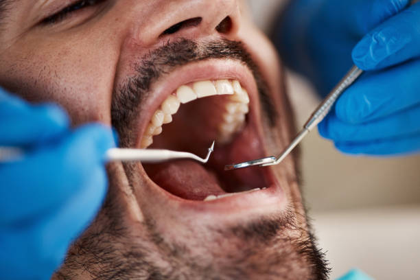 Best Urgent Tooth Repair  in Nemacolin, PA